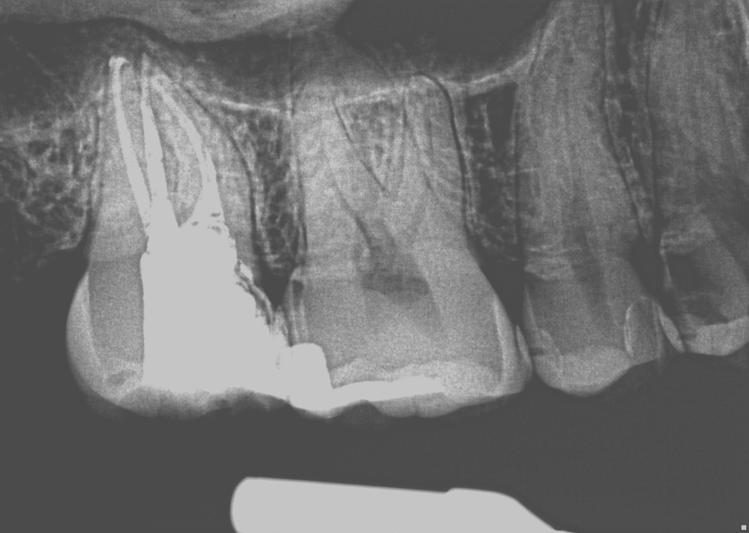 Post-Operative Radiograph