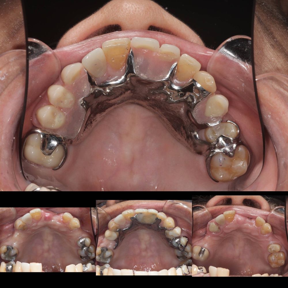 Maxillary View