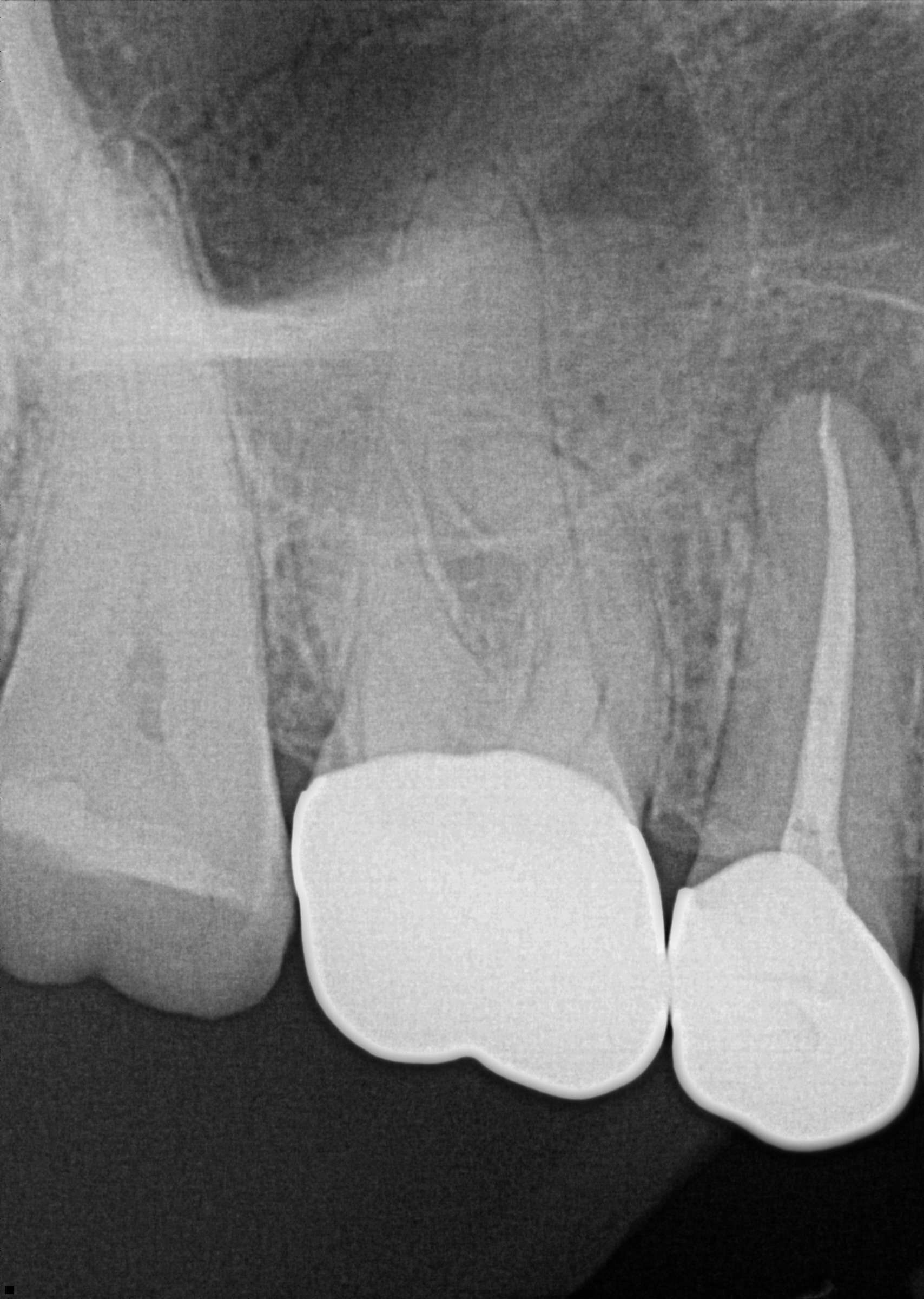 Post-Operative Radiograph