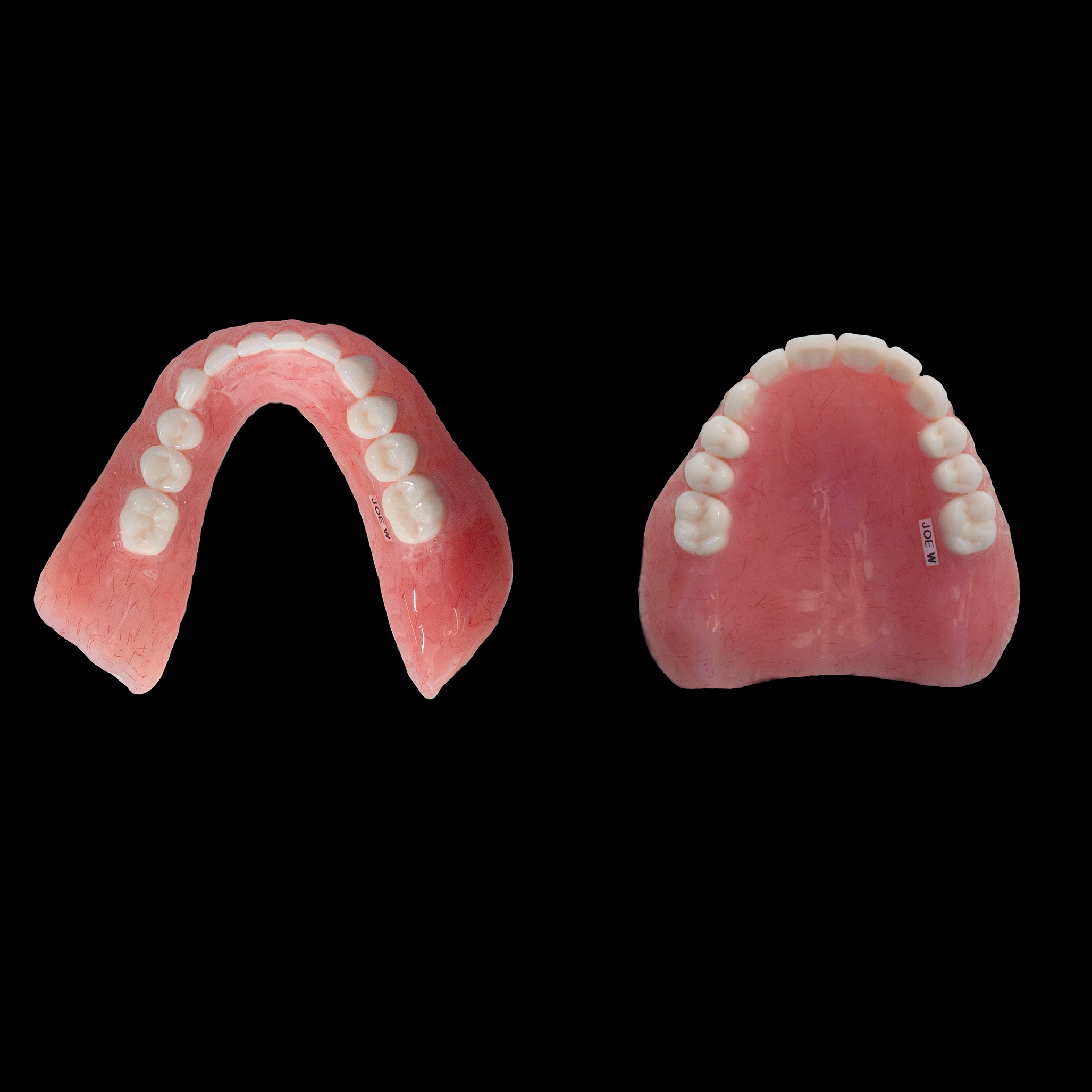 Finished Occlusal View