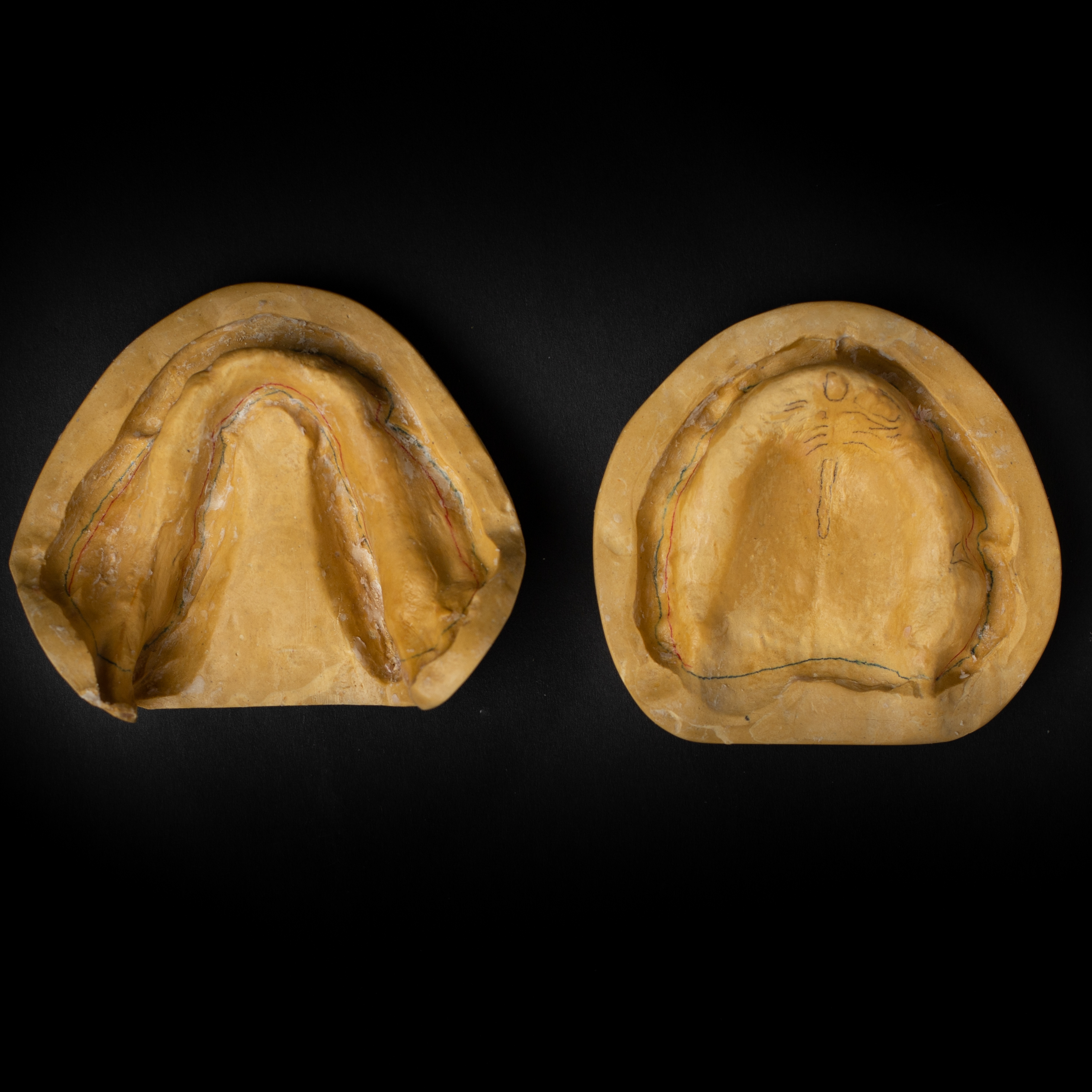 Primary Cast Occlusal View