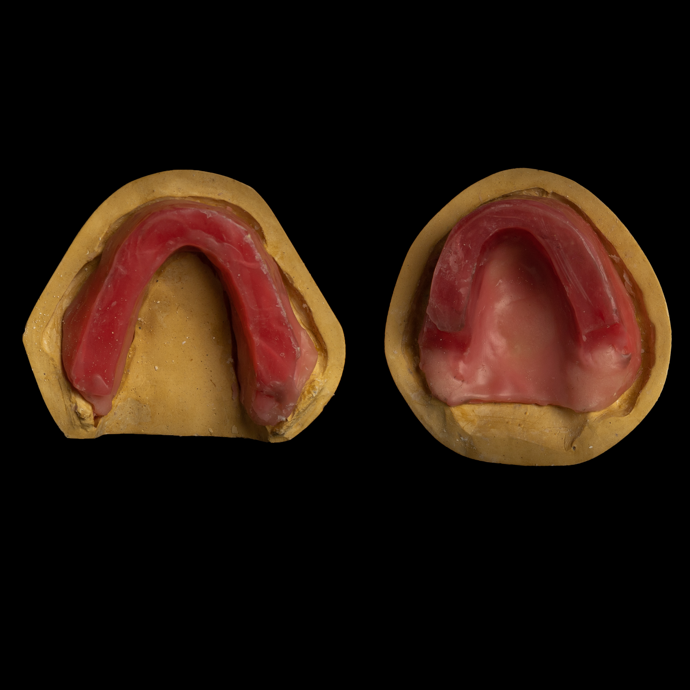 Occlussal rims  Occlusal View