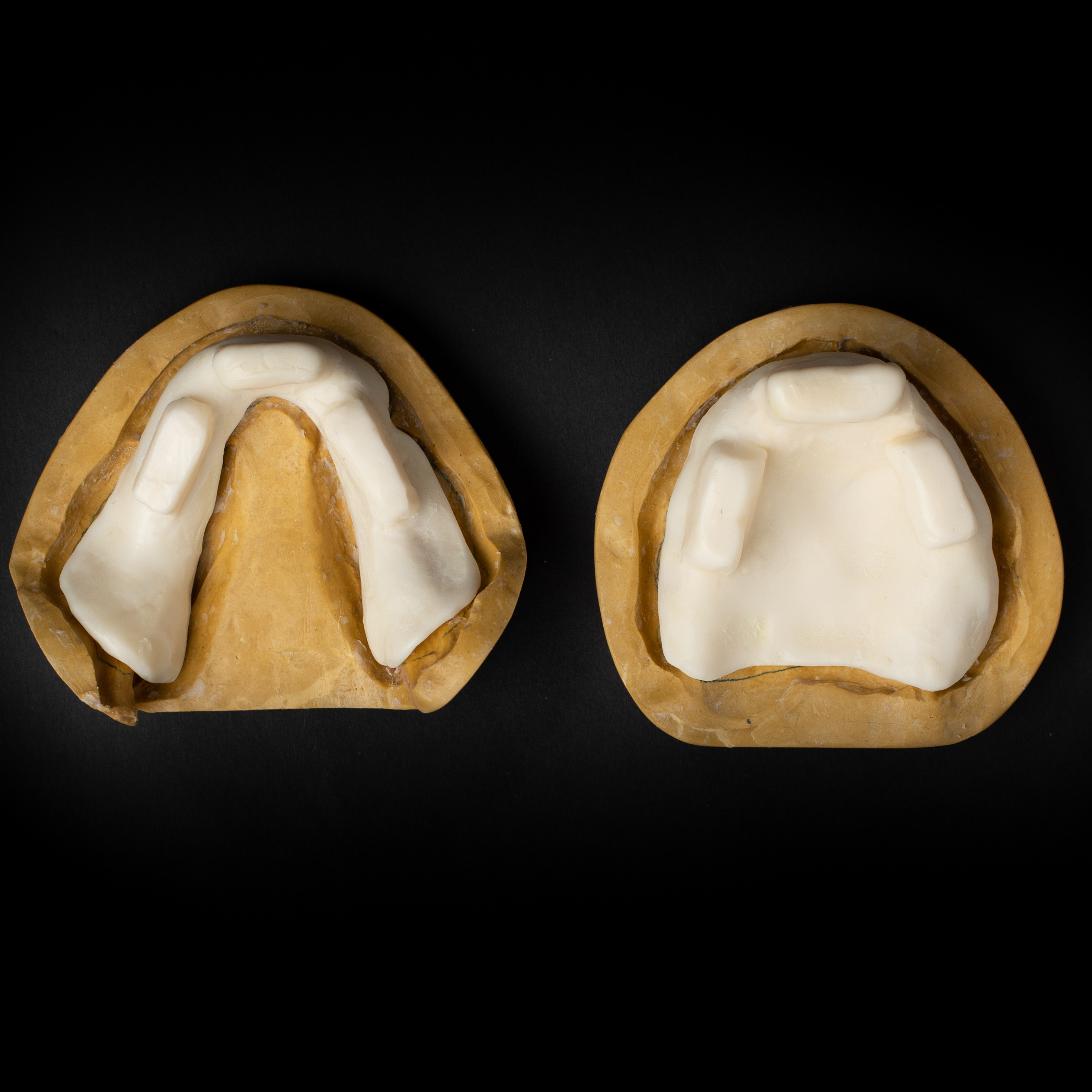 Special Trays Occlusal View