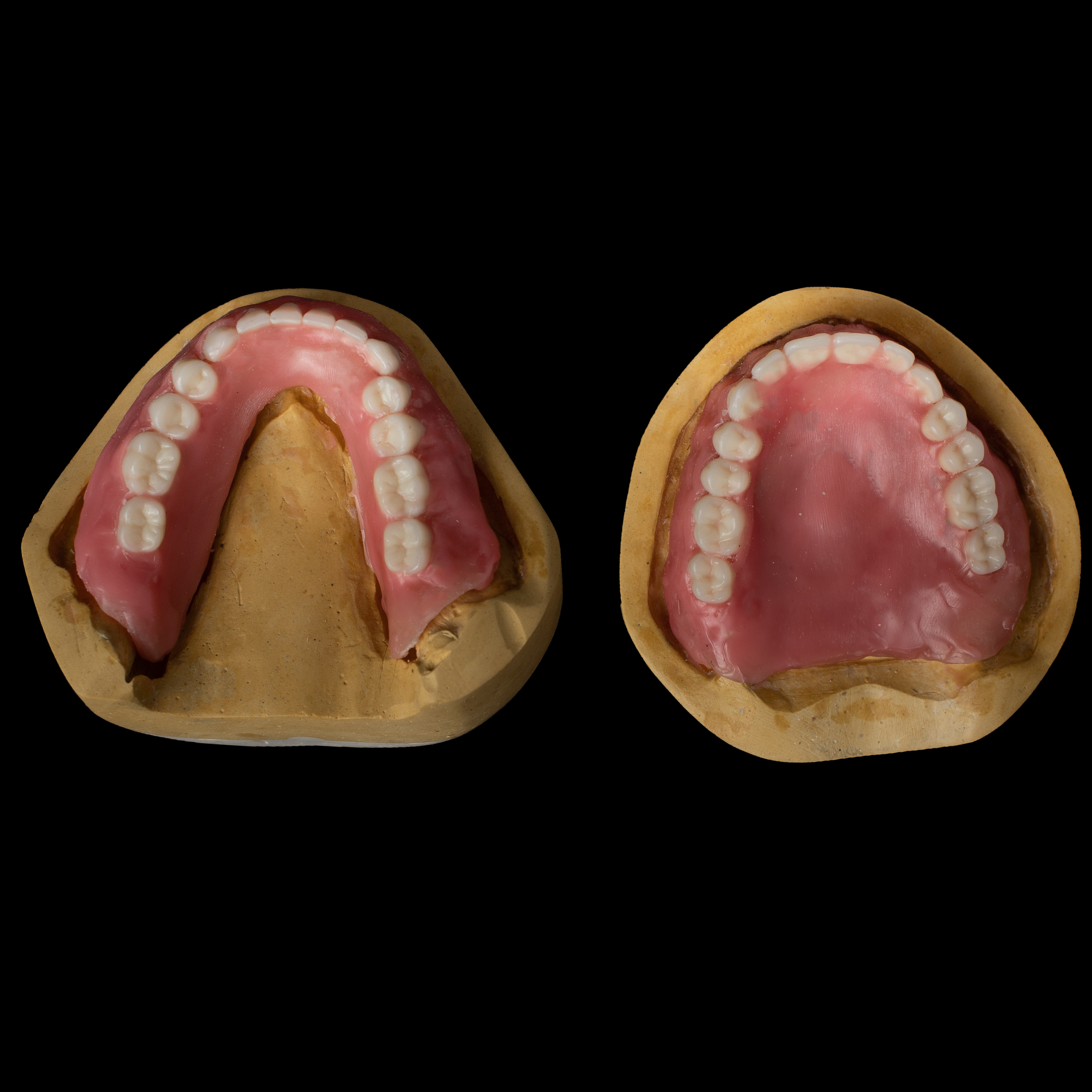 Try in  Occlusal View