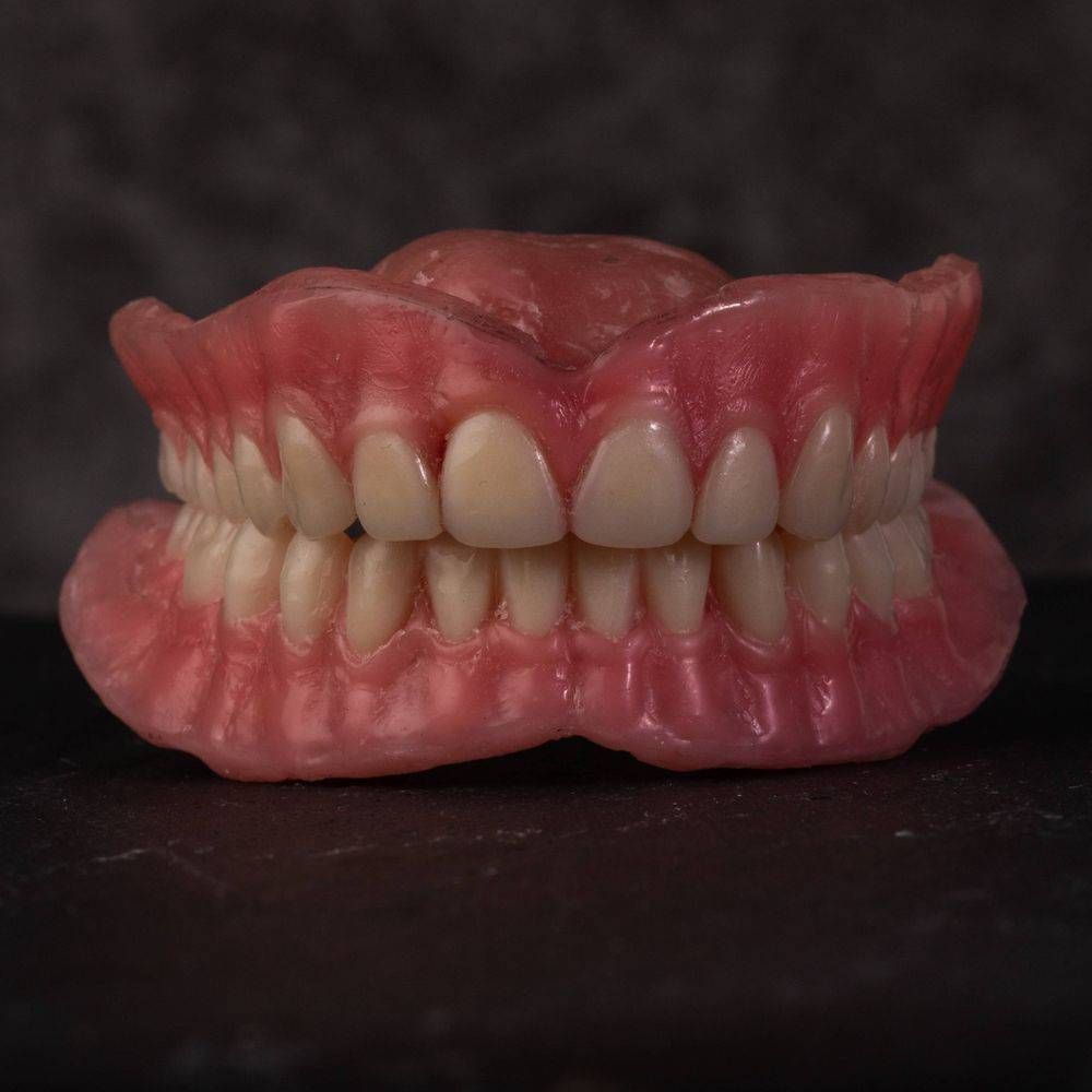 Denture Wax up