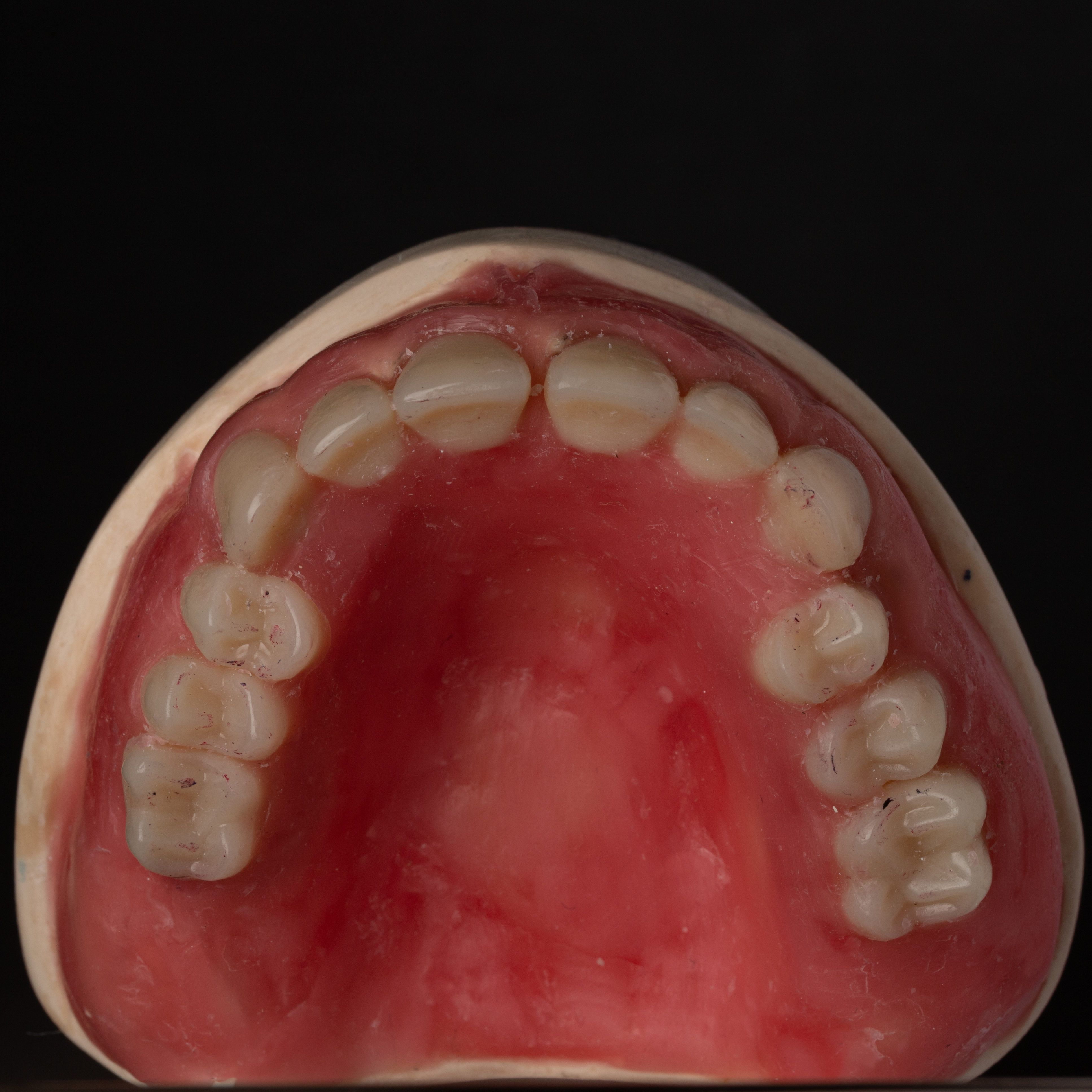 Wax up Occlusal View