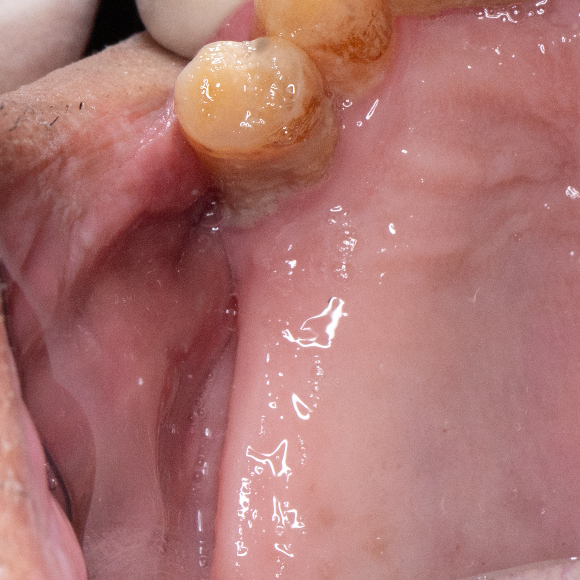 Pre-Operative Occlusal View
                                        