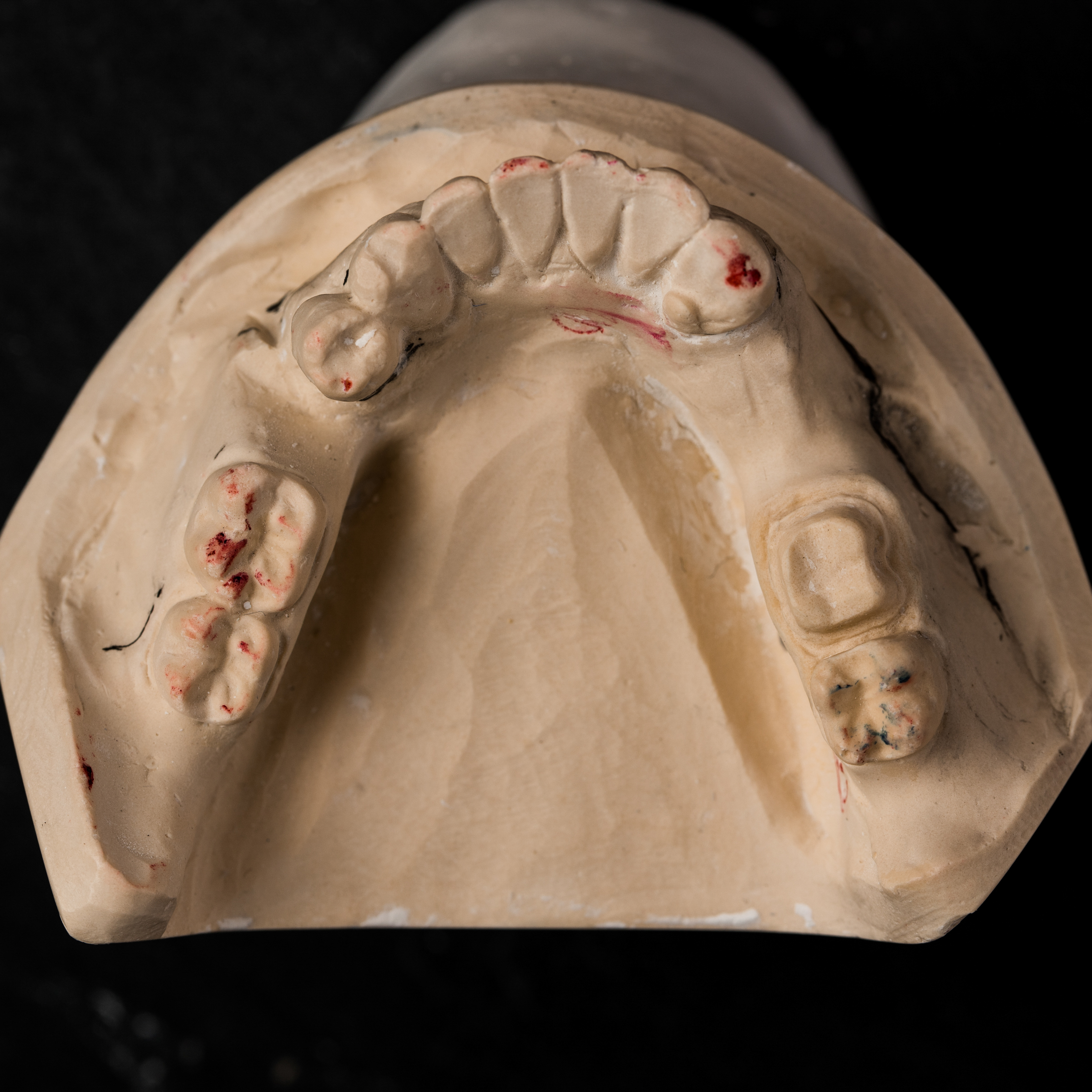 Wax up Cast Occlusal View